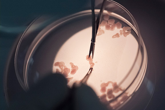 probenentnahme Probenentnahme